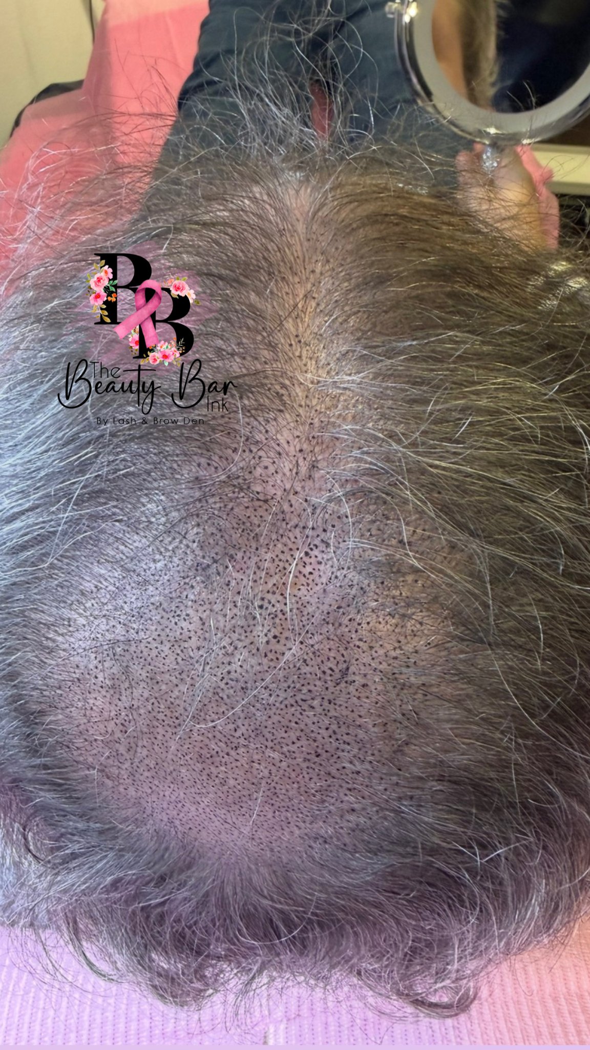 Scalp micropigmentation result